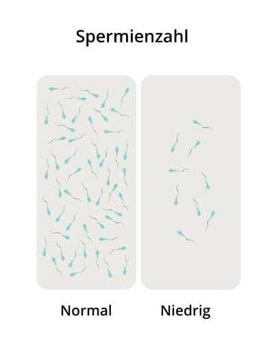 Análisis de seminograma en laboratorio