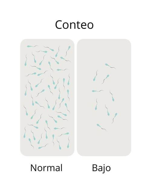 Análisis de seminograma en laboratorio