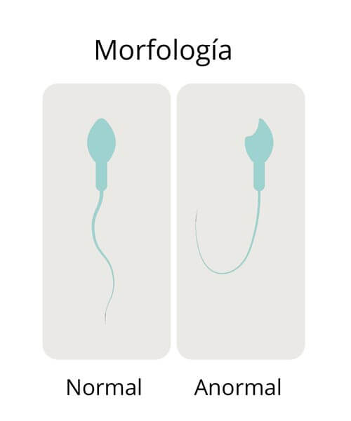 Evaluación microscópica del semen