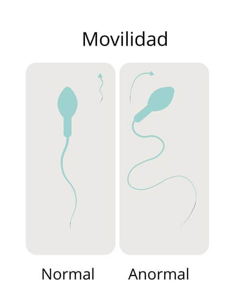 Estudio de espermatozoides