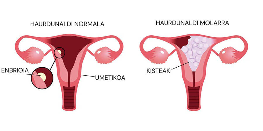 Haurdunaldi molarra infografia