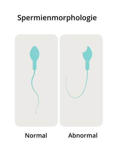Evaluación microscópica del semen