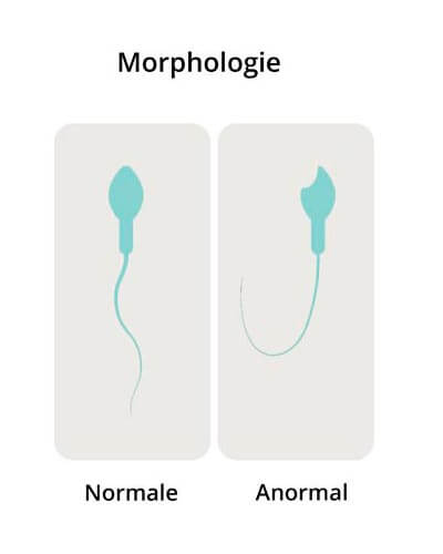 Morphologie des spermatozoïdes