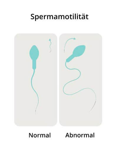 Estudio de espermatozoides