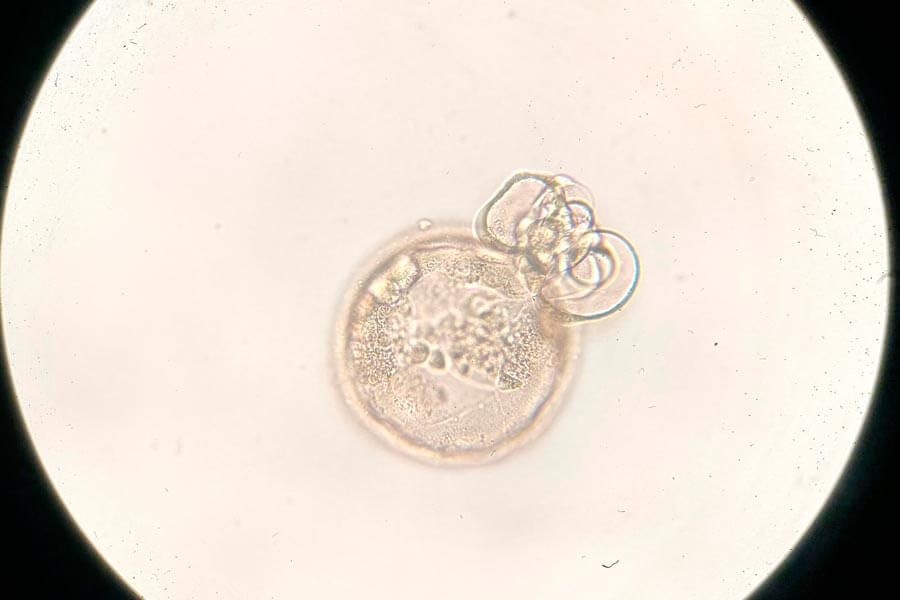 Embryo im Blastozystenstadium