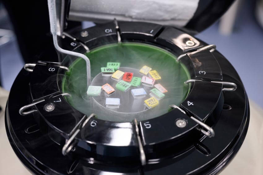 Criopreservación de gametos en laboratorio