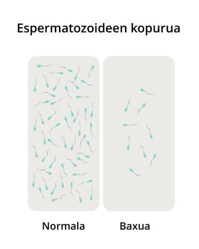 Análisis de seminograma en laboratorio