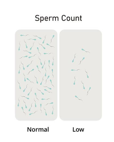 Laboratory semen analysis