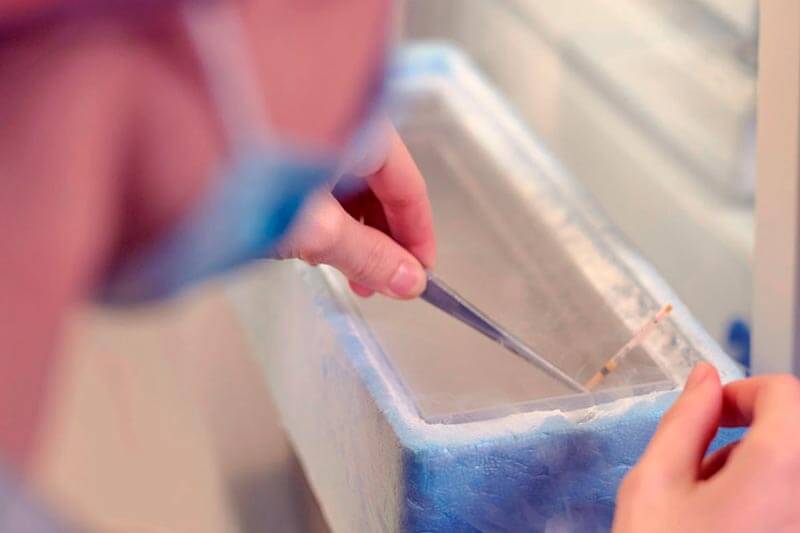 Criopreservación laboratorio IVF-Life