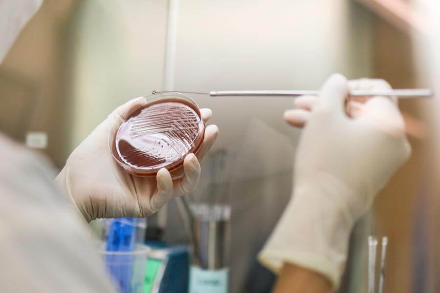 Cultivo en laboratorio para detectar enfermedades de transmisión sexual