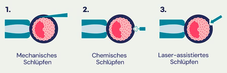 Infografik zum unterstützten Schlüpfen