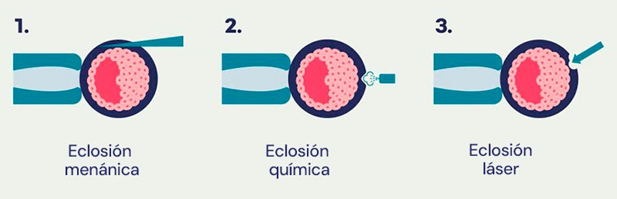 Infografía del hatching asistido
