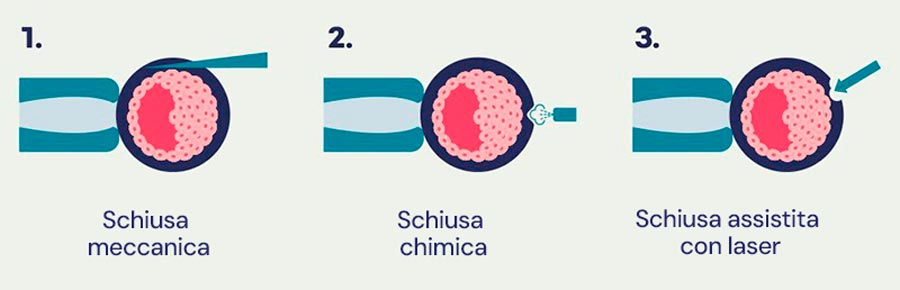 Infografica sulla schiusa assistita