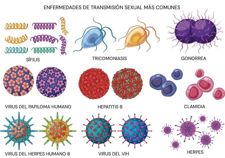 Enfermedades de transmisión sexual más comunes