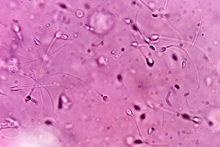 Espermatozoides vistos al microscopio