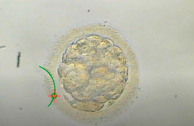 Hatching assistito presso il laboratorio IVF-Life Donostia
