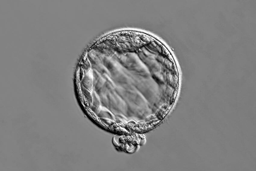 Blastocisto visto al microscopio