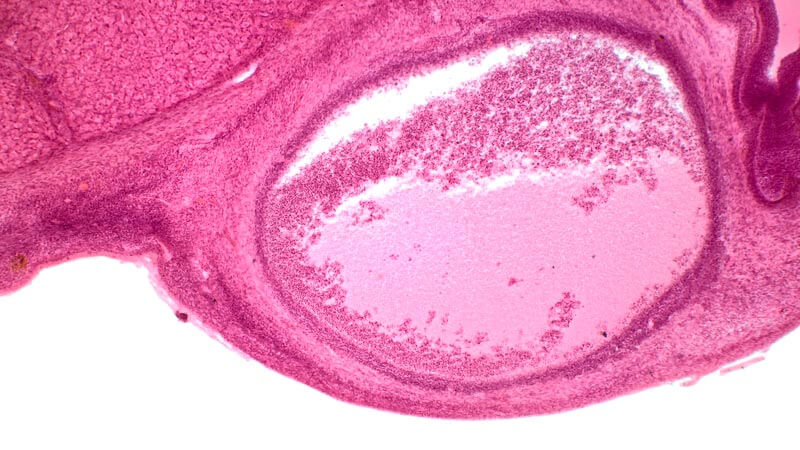 Micrografía del ovario humano que muestra folículo de Graafian que contiene ovocitos secundarios.