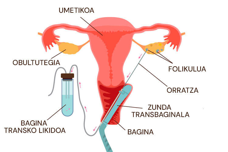 Obulutegiko zulaketa infografia