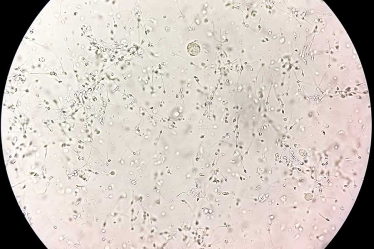 Espermatozoides vistos al microscopio