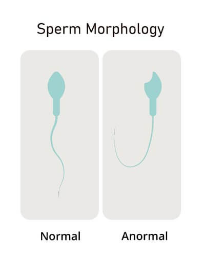 Microscopic evaluation of semen