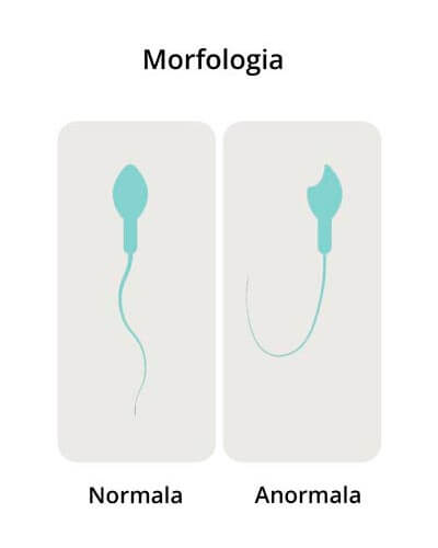 Evaluación microscópica del semen