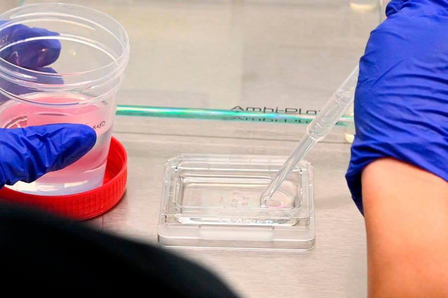 Muestra de congelación de óvulos en IVF-Life