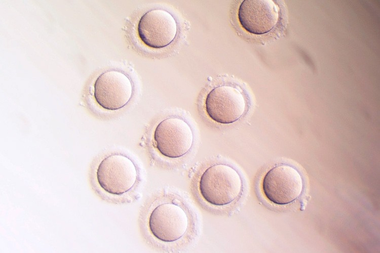 Arrautzak mikroskopiopean ikusita
