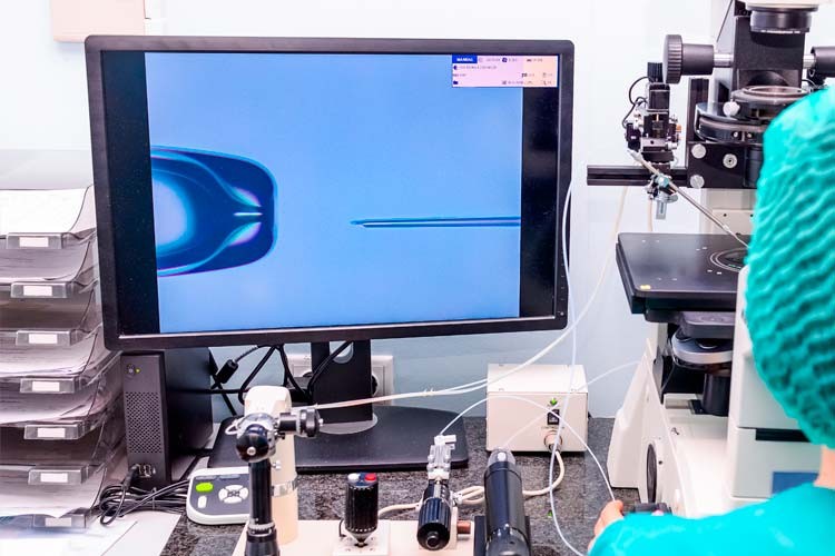 Trattamento di fecondazione in vitro presso il laboratorio IVF-Life