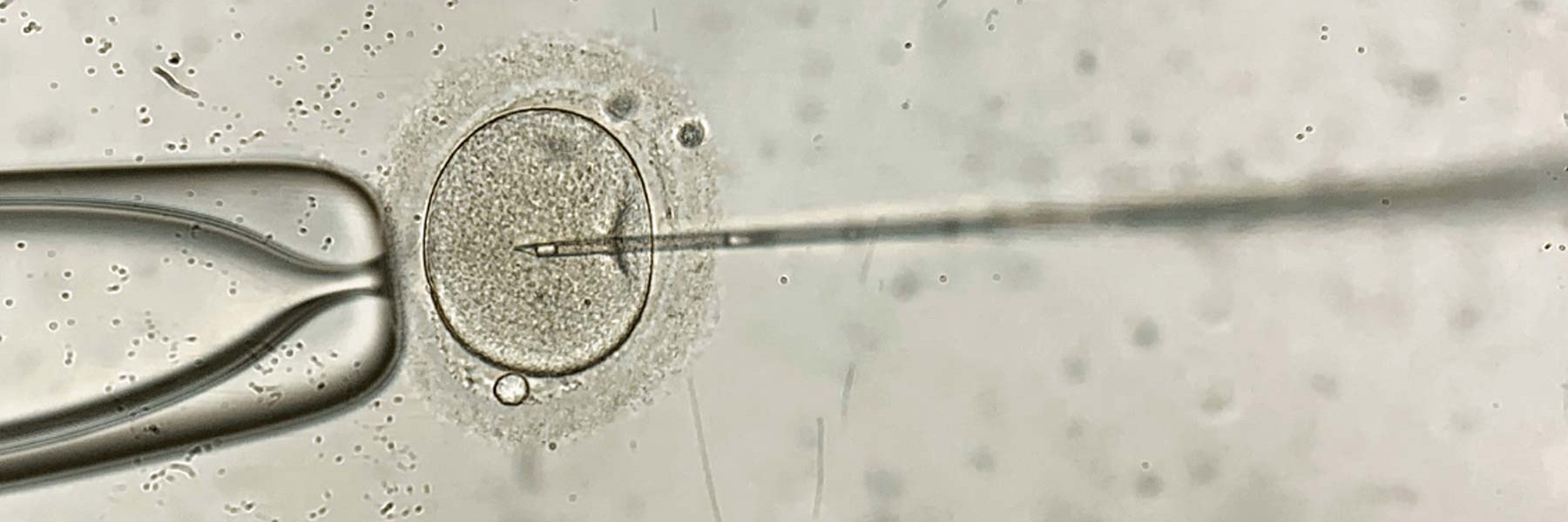 Óvulo fecundado por espermatozoide en laboratorio