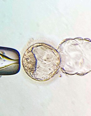 in vitro ernalketa mikroskopiopean