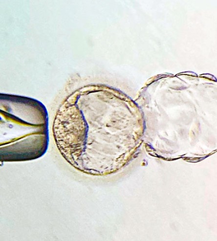 in vitro ernalketa mikroskopiopean