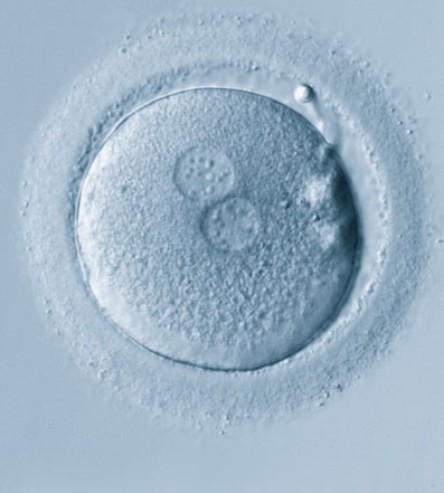 Un ovule donné vu au microscope