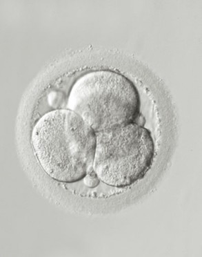 Embryoteilung - ROPA-Methode
