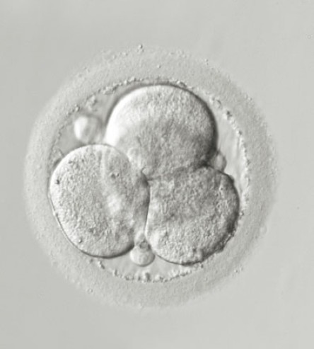 Embryoteilung - ROPA-Methode