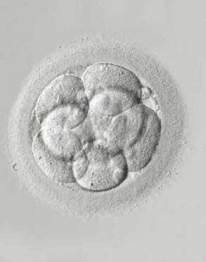Embryoteilung für die ROPA-Behandlung
