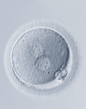 Ovum zur Behandlung alleinerziehender Mütter