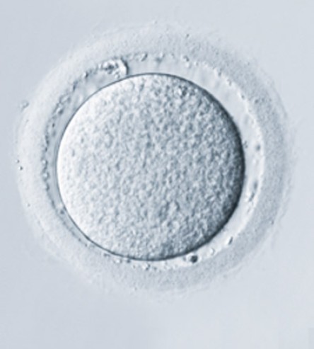Óvulo de preservación de la fertilidad visto al microscopio