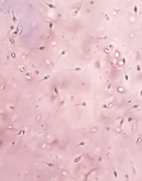 Espermatozoides al microscopio para preservación de la fertilidad