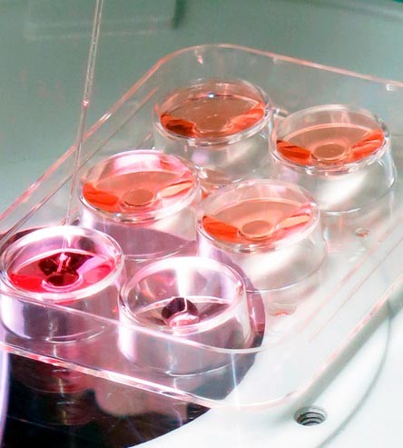 In vitro ernalketa laborategian