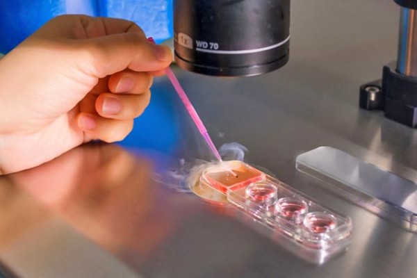 Embriólogo analizando muestra en busca de enfermedades genéticas recesivas