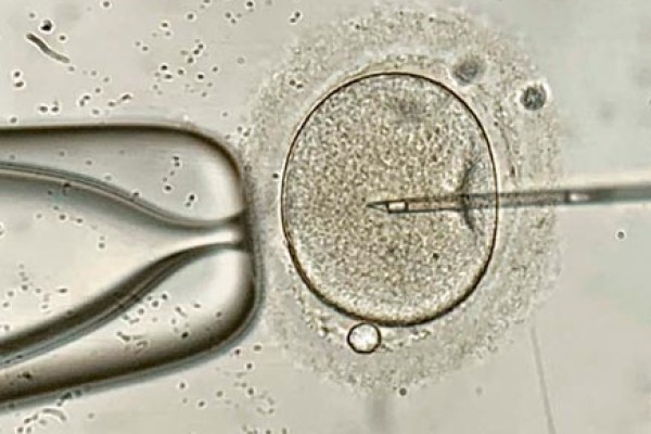 Óvulo fecundado por espermatozoide en laboratorio