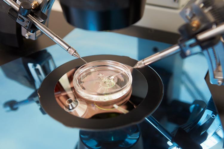 Aneuploidy study in the IVF-Life laboratory