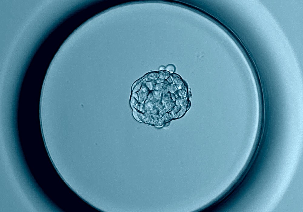 cultivo y transferencia a blastocisto al microscopio