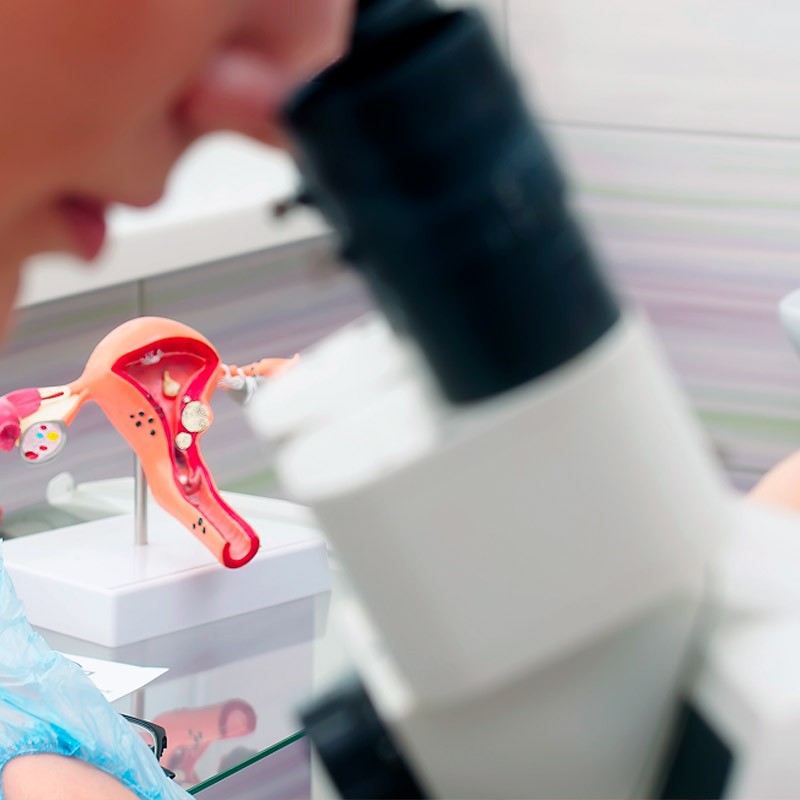 Consulta IVF-Life por fallo ovárico precoz