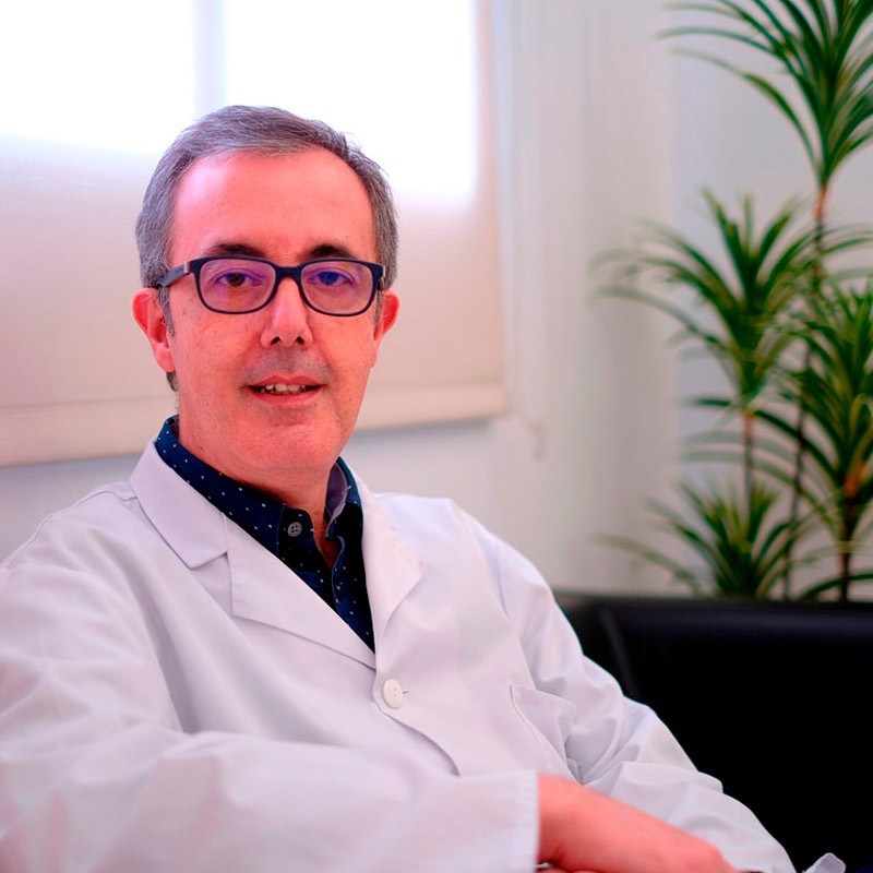 Dr. Manuel Izquierdo contestando preguntas frecuentes del síndrome de los ovarios poliquísticos