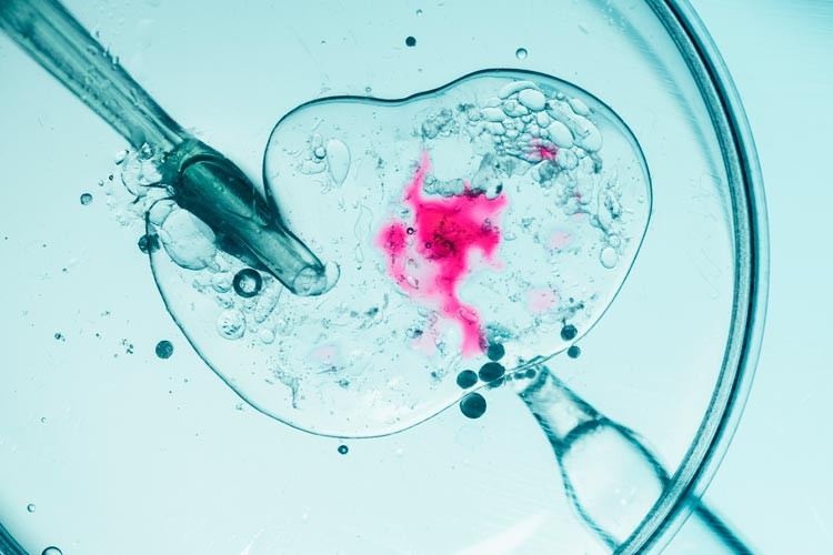 Muestra vista al microscopio