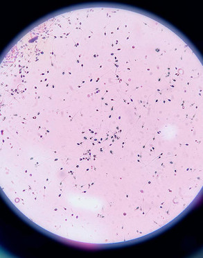 Intseminazio artifizialerako esperma lagina