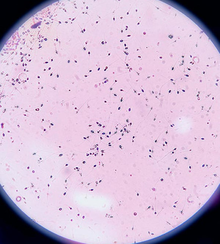Intseminazio artifizialerako esperma lagina