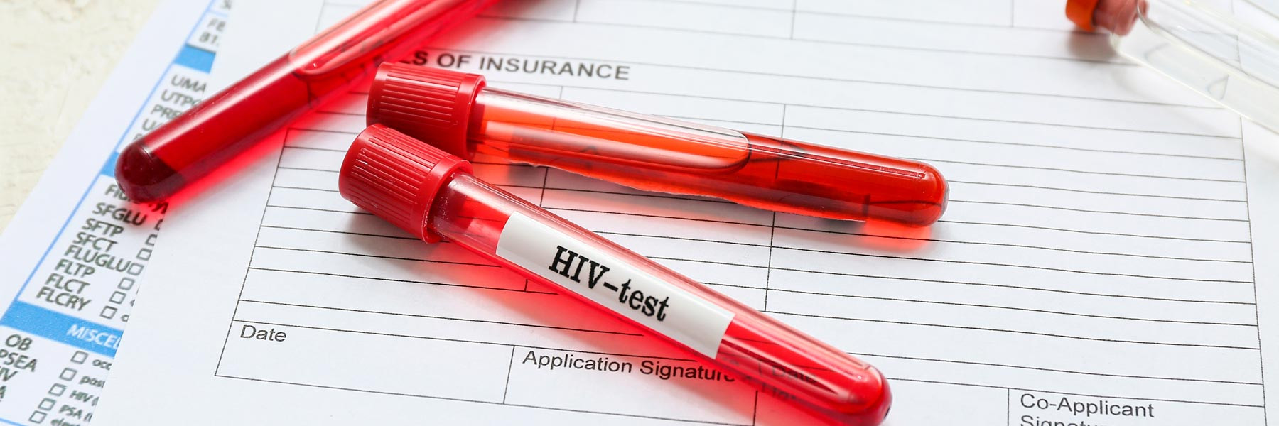 Muestras de sangre para análisis de VIH